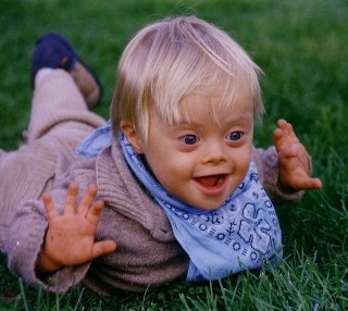 Child with down syndrome