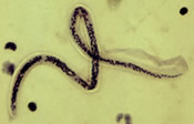 Wuchereria bancrofti. Image credit: CDC