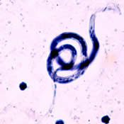 Brugia malayi. Image credit: CDC