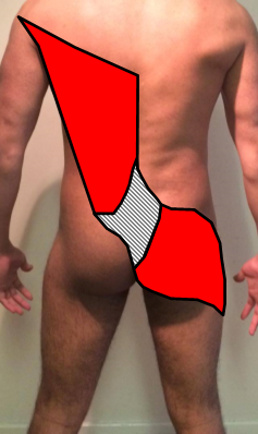 Image (P1): The posterior oblique sling consists of the latissimus dorsi, contralateral gluteus maximus, and the inter-connecting thoraco-lumbar fascia