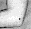 Image:Medial_elbow.jpg