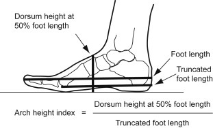 Arch Index