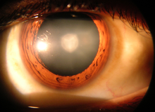 Photograph by Rakesh Ahuja, MD, from Wikipedia