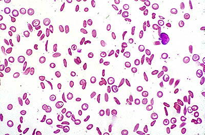 Image:Case1_1.jpg