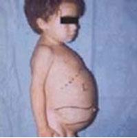 Image:Little_boy_2.JPG