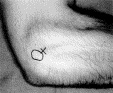 Image:Lateral_elbow.jpg