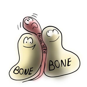 The image shows how narrow the facial canal is, with the nerve surrounded by unyielding bone.