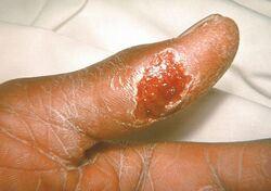 http://pathmicro.med.sc.edu/ghaffar/zoonoses.htm