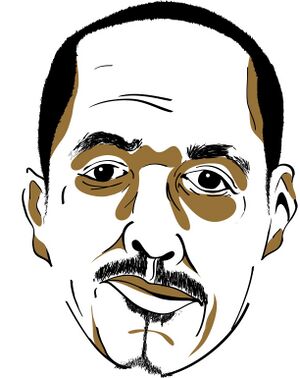 Illustration of left sided flaccid facial palsy , position at rest. It shows the absence of horizontal forehead lines on the left, larger left eye and lower resting position of left corner of the mouth.