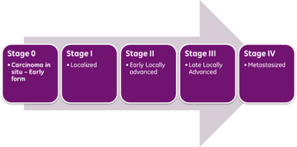 Stages of Prostate Cancer
