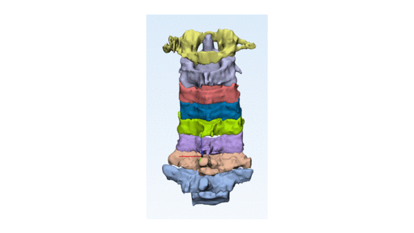 Segmental movement that is intended to occur with Cervical