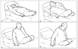 Sitting up: patient bilateral amputation