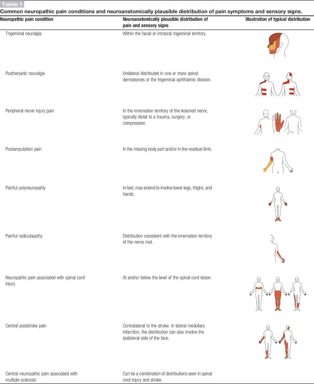 Image indicating the pain patterns in different neuropathic pain conditions