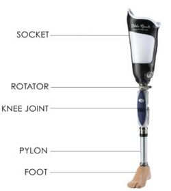 Transfemoral prosthetic components