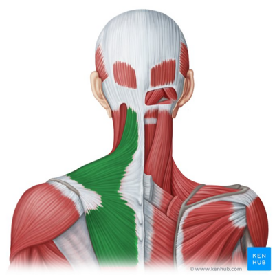 Trapezius Myalgia