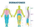 Dermatomal distribution