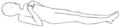 Decorticate posturing