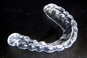 Occlusal Splint