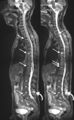Example of MRI image