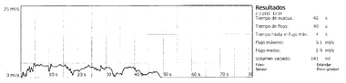 Uroflowmetry obstruction es.png