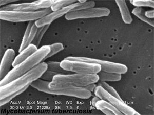 Mycobacterium Tuberculosis