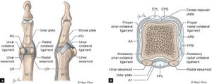 Anatomy of the thumb MCP joint. Illustrations depicting: A. Coronal and sagittal views of the relevant supporting structures at the thumb MCP joint including volar plate complex, consisting of the phalangoglenoid and checkrein ligaments. B. Transverse illustration at the level of the MCP joint shows important static stabilizers, along with key dynamic stabilizers: the extensor pollicis longus and brevis, flexor pollicis longus, flexor pollicis brevis, and abductor pollicis brevis. The adductor aponeurosis overlies the UCL.
