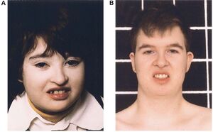 https://www.sciencedirect.com/science/article/pii/S0002929707604376