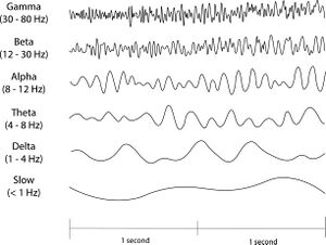 EEG waveform examples