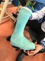 Total contact cast