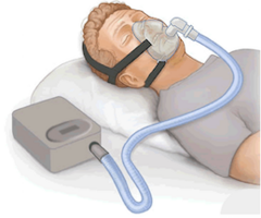 https://en.wikipedia.org/wiki/Positive_airway_pressure