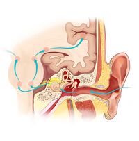 Steps involved in hearing speech: Sound signals travel from the ear to the brain where they are recognized and decoded