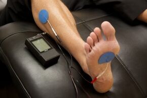 TENS therapy