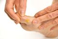 Callus