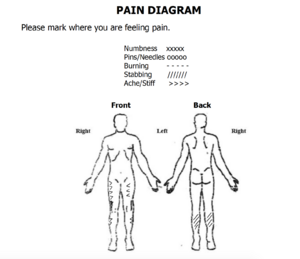 A pain diagram showing human body from the front and back. Achy pain represented by arrows on the front of both thighs and outside front of both calves. Stabbing/sharp pain, represented by oblique lines, located on back of calves.