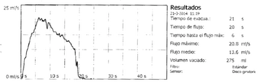 Uroflowmetry normal es.png