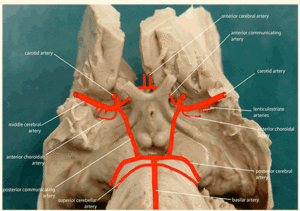 Circle of Willis