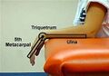 Goniometer position for wrist flexion and extension