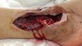 White arrow indicates bone, red arrow points to muscle.