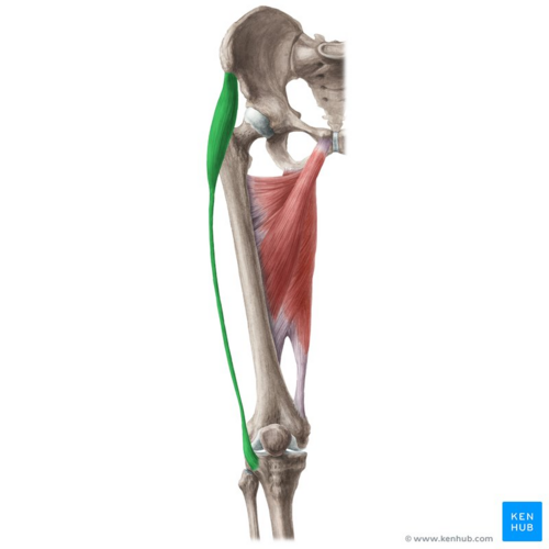 TFL - anterior view