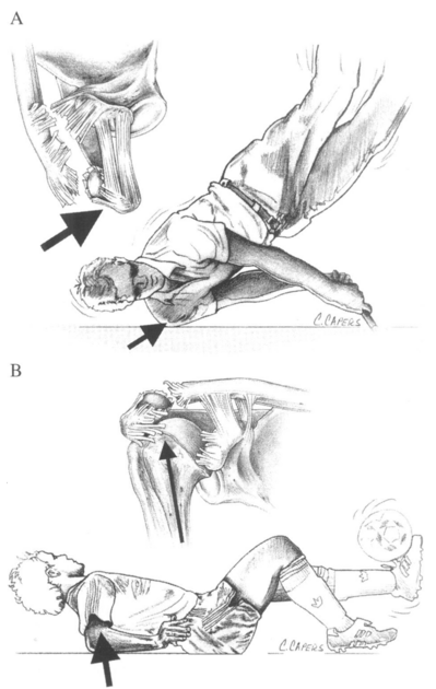 Mechanism of AC injury's