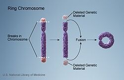 Ring chromosome