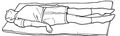 Decerebrate posturing